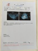 怀孕b超单图片在线制作工具