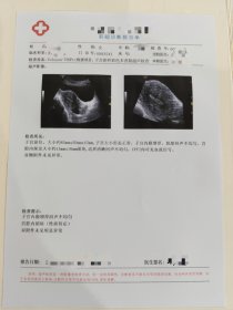 孕期食谱蒜蓉开边虾